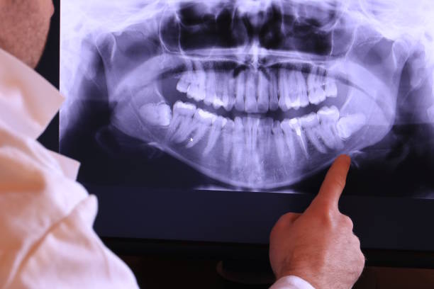 Best Emergency Dentist for Lost Fillings or Crowns in Weweantic, MA